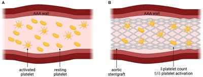Platelet function changes in patients undergoing endovascular aortic aneurysm repair: Review of the literature